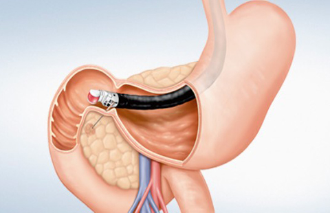 Ультразвуковой видеогастроскоп Olympus GF-UCT160-OL5