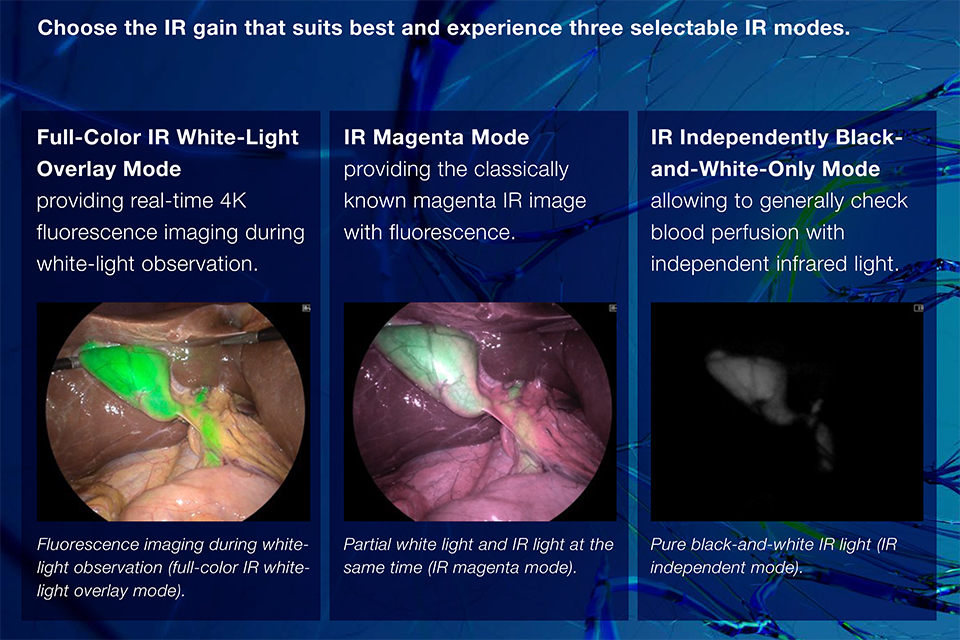 Эндохирургическая система Olympus VISERA ELITE III